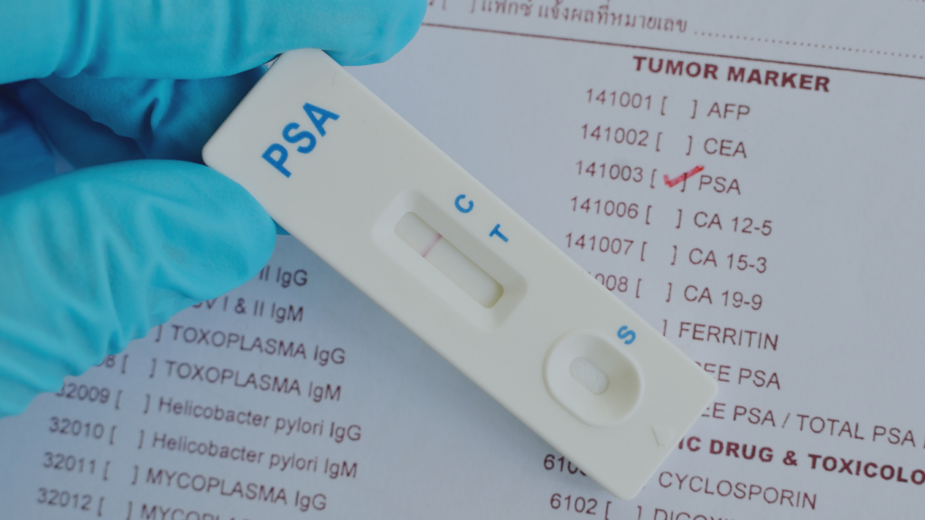 Exame de PSA, para falar sobre o PSA sem pedido médico