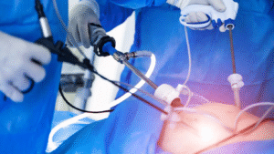 Médicos fazendo a prostatectomia robótica